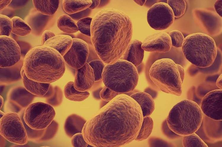 Understanding the rise of leukemia