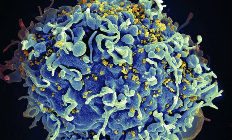 Second patient free of HIV after undifferentiated organism treatment